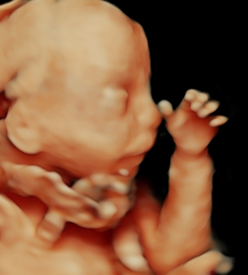 3D и 4D УЗИ при беременности, ультразвуковое исследование плода 3D и 4D с 14 недели беременности