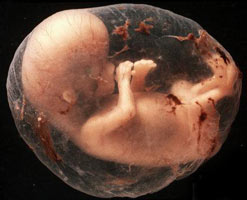 Размером с фасолинку: как развивается беременность на 8-й неделе (фото)